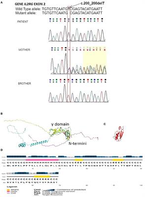 Novel IL2RG Gene Mutation in One of Dizygotic Twins Causing Profound Changes of Receptor Structure